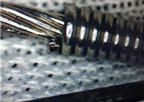 医疗钢缆 医疗钢缆